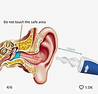 Ear Wax Removal Tool Ear Wax Removal Tool